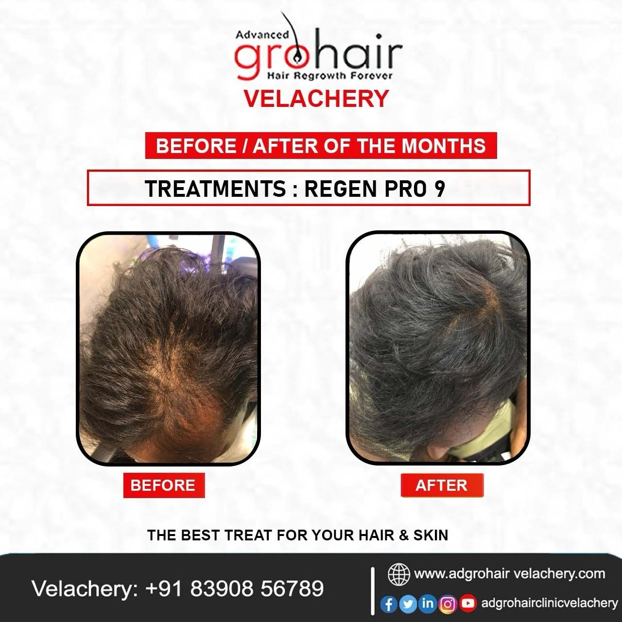 WhatsApp Image 2025-03-19 at 10.55.42