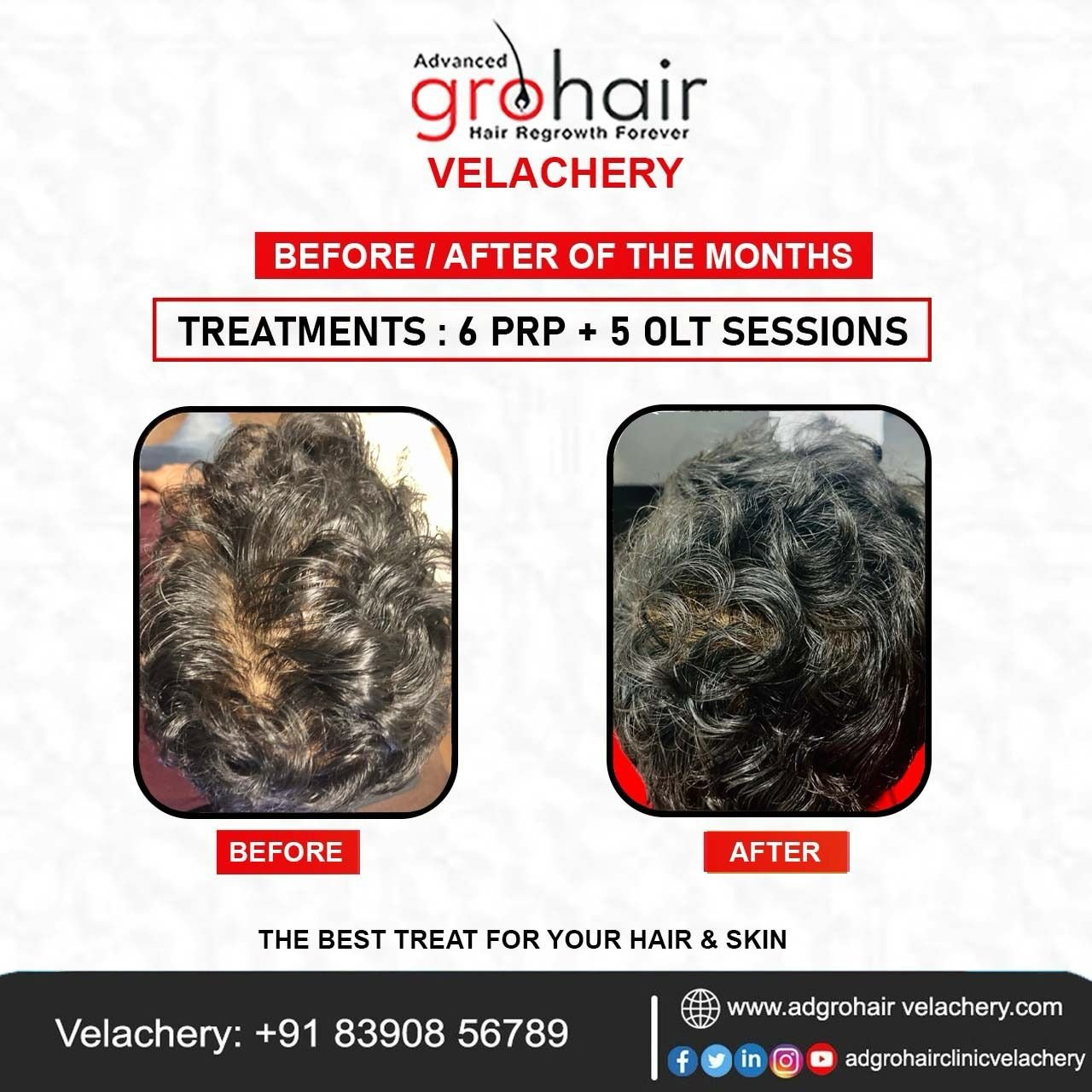 WhatsApp Image 2025-04-16 at 12.11.27_eadbcf30